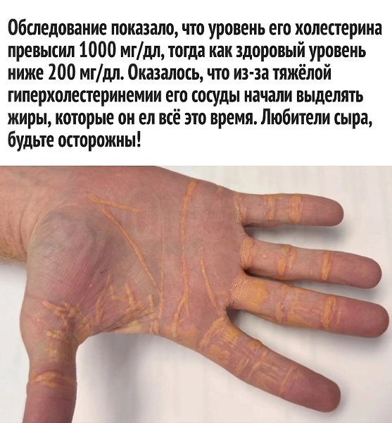         - 3