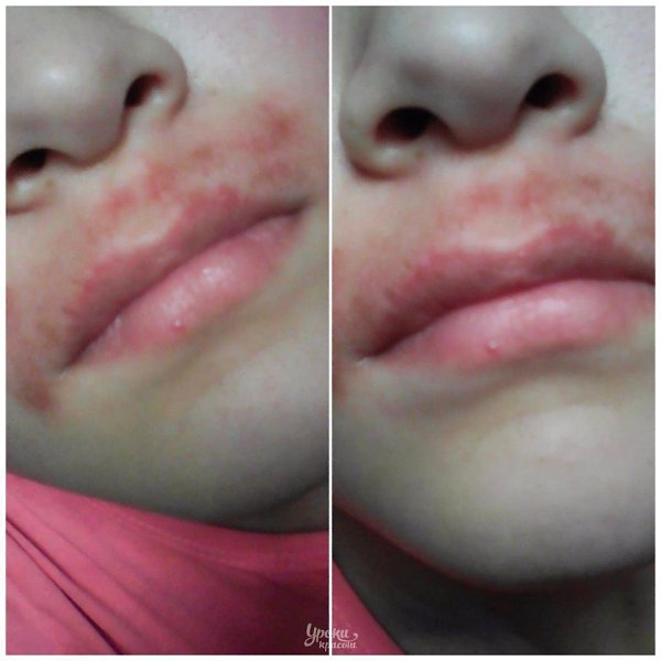 eo,  aa pa!!! eaa cee e oco a e, a oa opace  ...