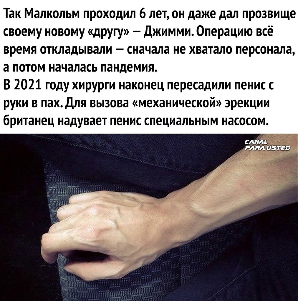 ��� �� ���� ����� ����� - 3