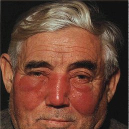 �����, 44 ����, �����-���������