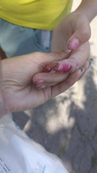 В Краснодарском крае 13-летняя девочка, проходившая лечение в психоневрологическом диспансере в ... - 2