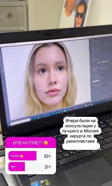 Дана Борисова отвела дочь к пластическому хирургу. Телеведущая не раз меняла свою внешность, и ... - 2