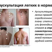 �������, 40 ���, ��������