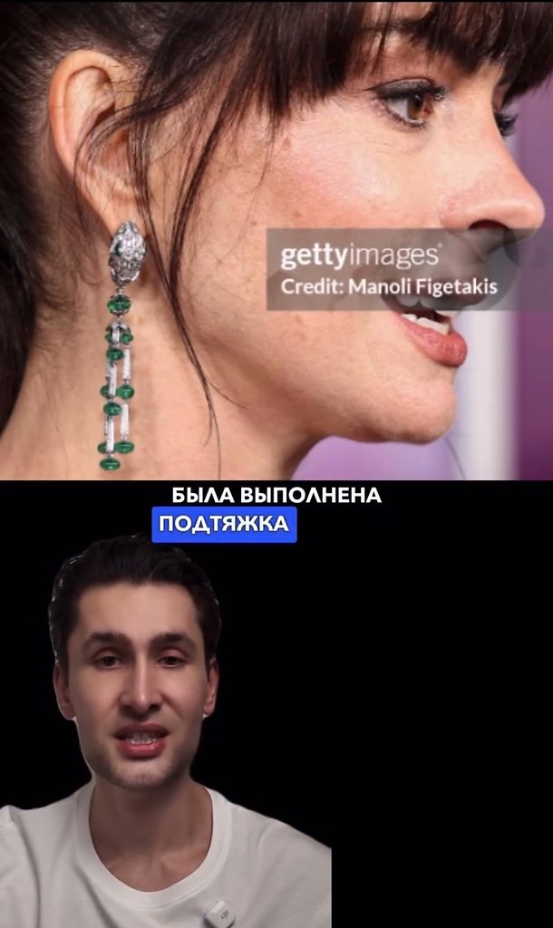    - 2