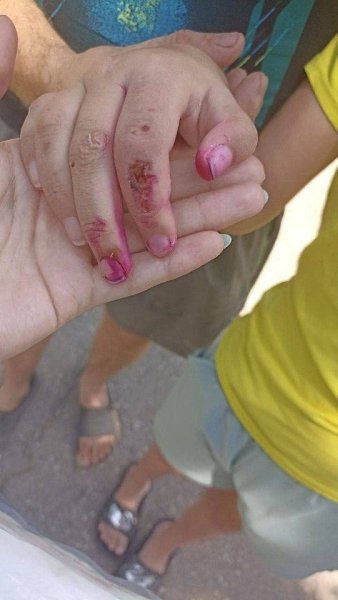 В Краснодарском крае 13-летняя девочка, проходившая лечение в психоневрологическом диспансере в ... - 3