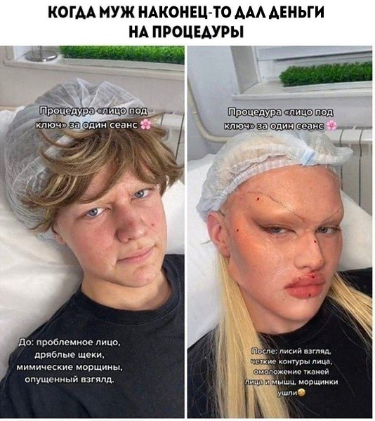 ��� ������ �����!