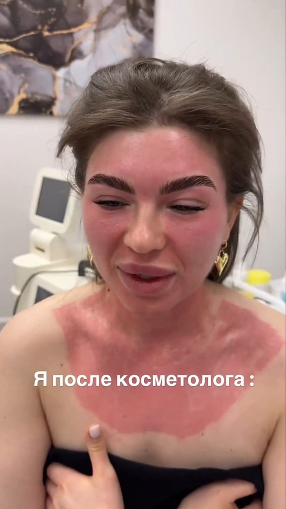     - 2